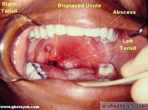 The pharynx