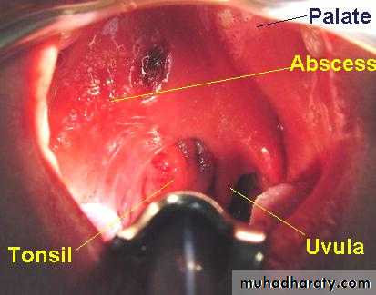 The pharynx