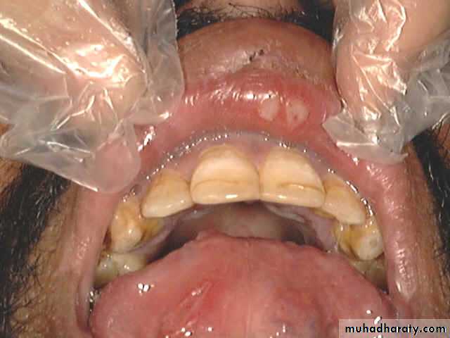 The pharynx