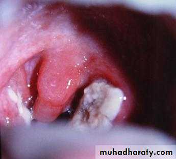 The pharynx