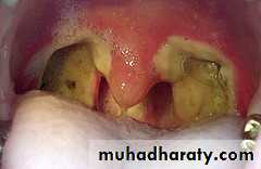 The pharynx