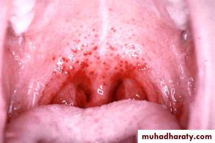 The pharynx