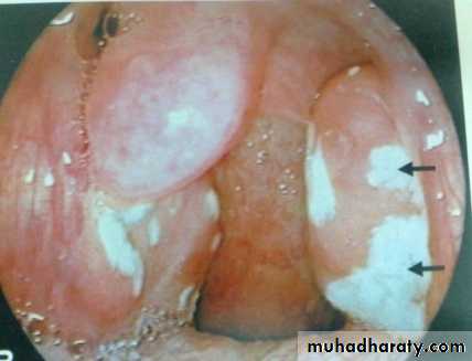 The pharynx