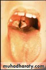 The pharynx