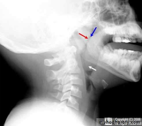 The pharynx