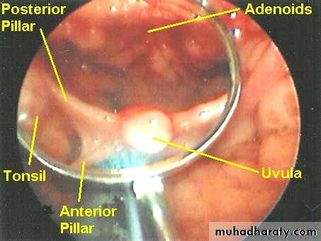 The pharynx