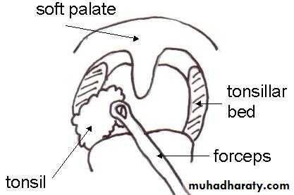 The pharynx