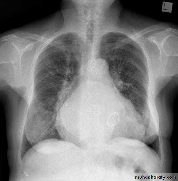 Chest Imaging