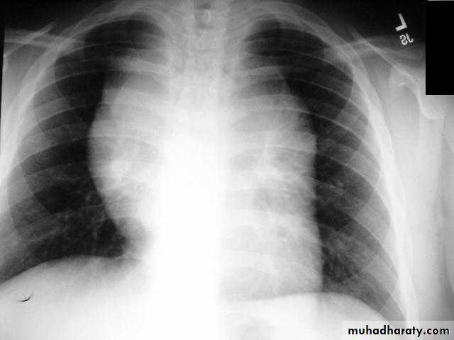 Chest Imaging