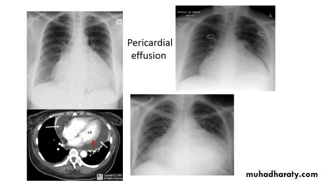 Chest Imaging
