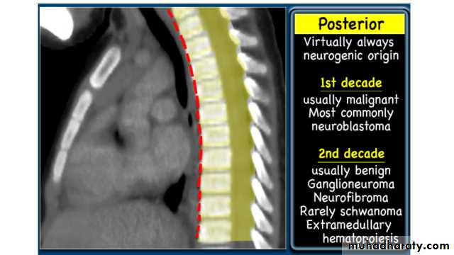 Chest Imaging