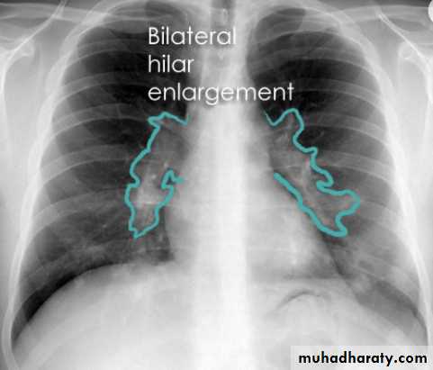 Chest Imaging