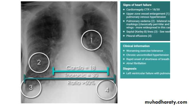 Chest Imaging