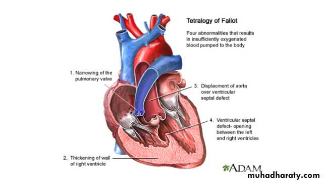 Chest Imaging