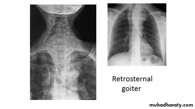 Chest Imaging