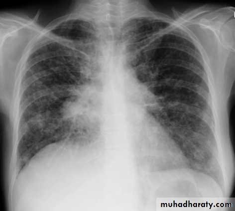 Chest Imaging