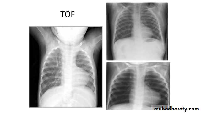 Chest Imaging