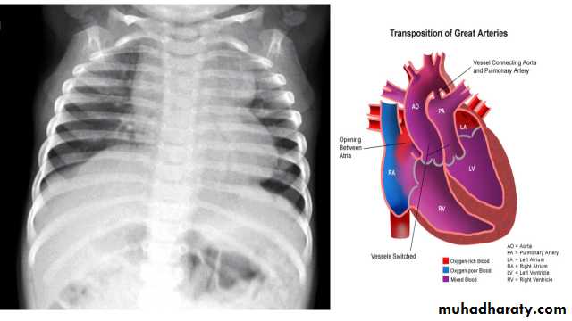 Chest Imaging