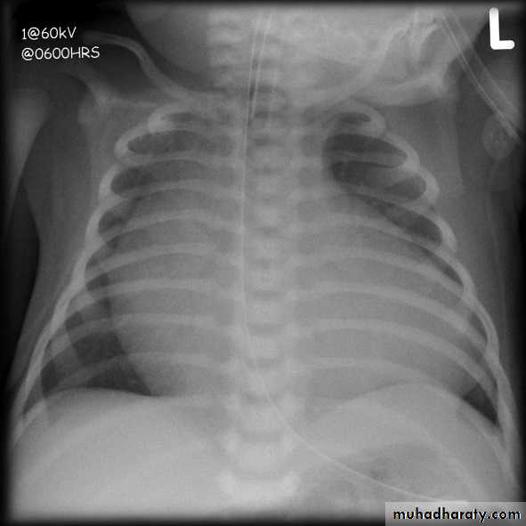 Chest Imaging