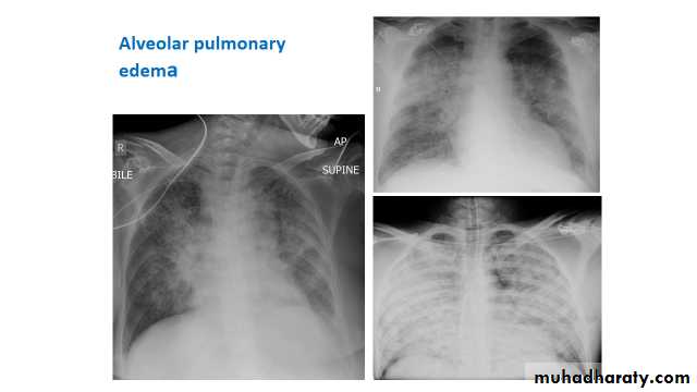 Chest Imaging