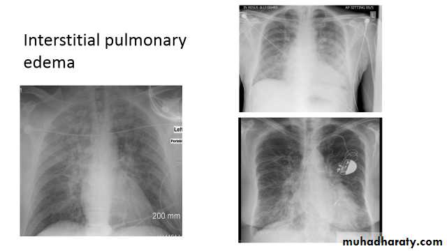 Chest Imaging