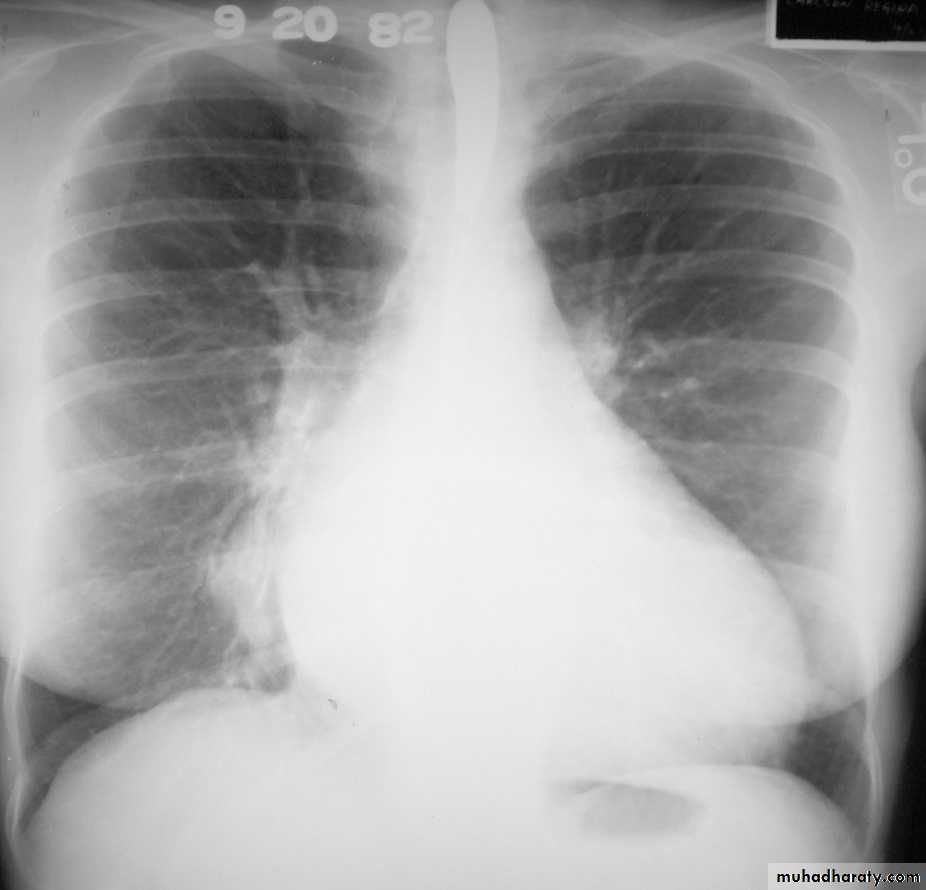Chest Imaging