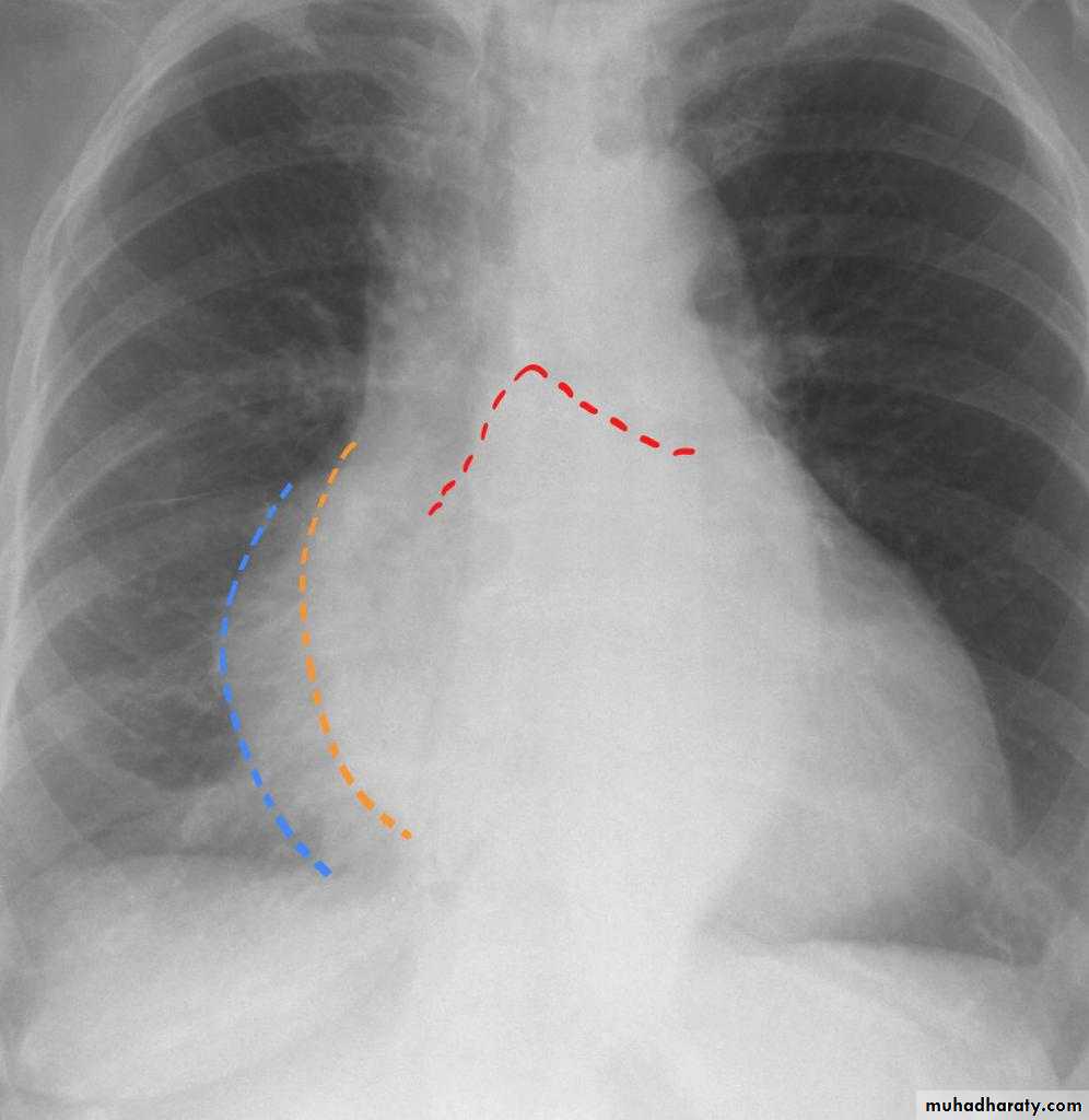 Chest Imaging