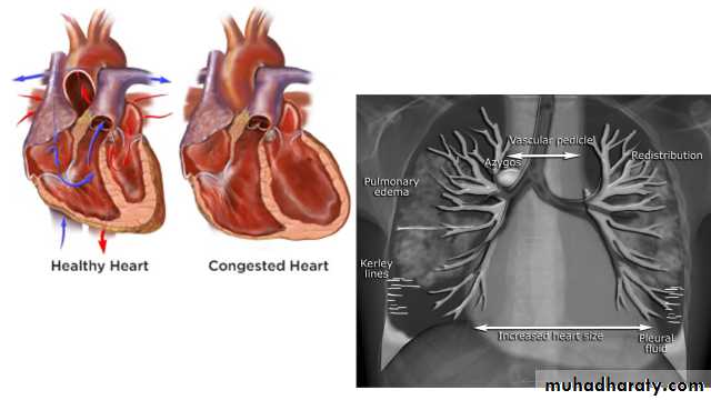 Chest Imaging