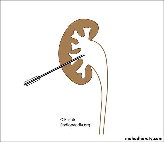 Urology