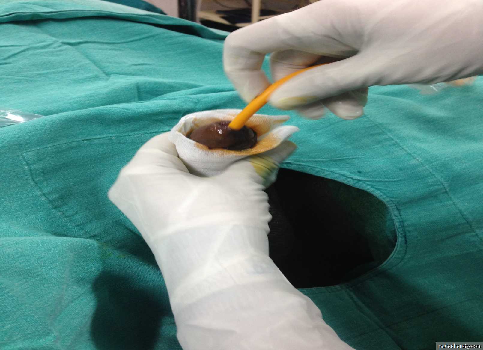 Urology