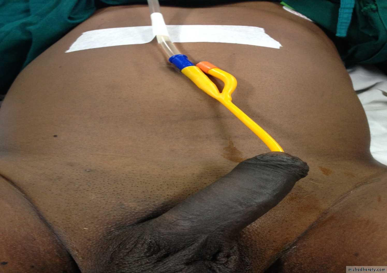 Urology