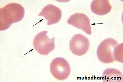 blood film