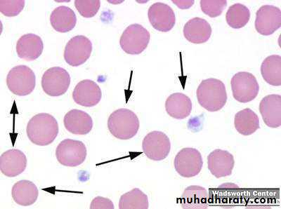blood film