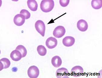 blood film