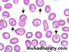 blood film