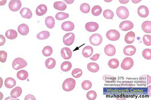 blood film