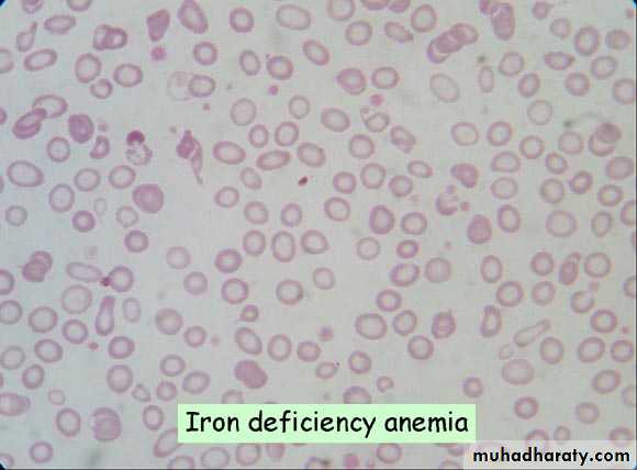 blood film