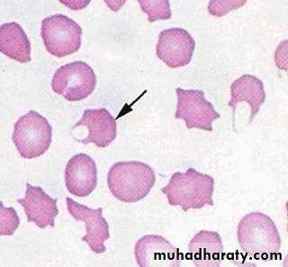 blood film