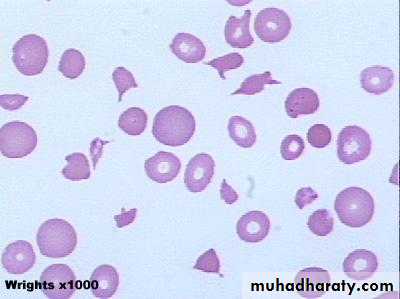 blood film