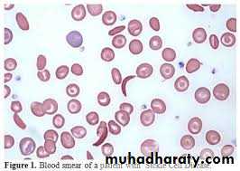 blood film