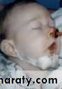 pediatric