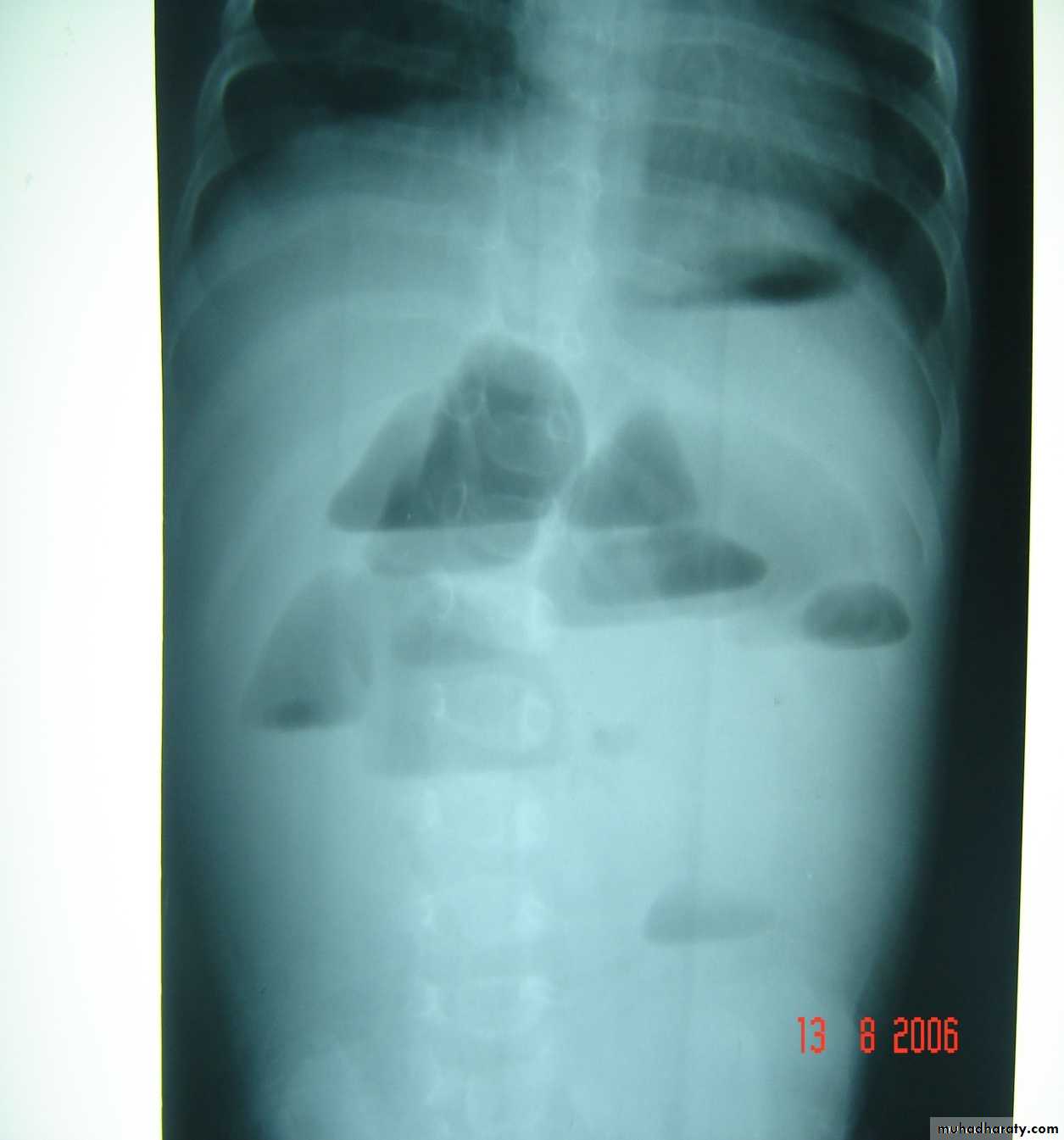 pediatric