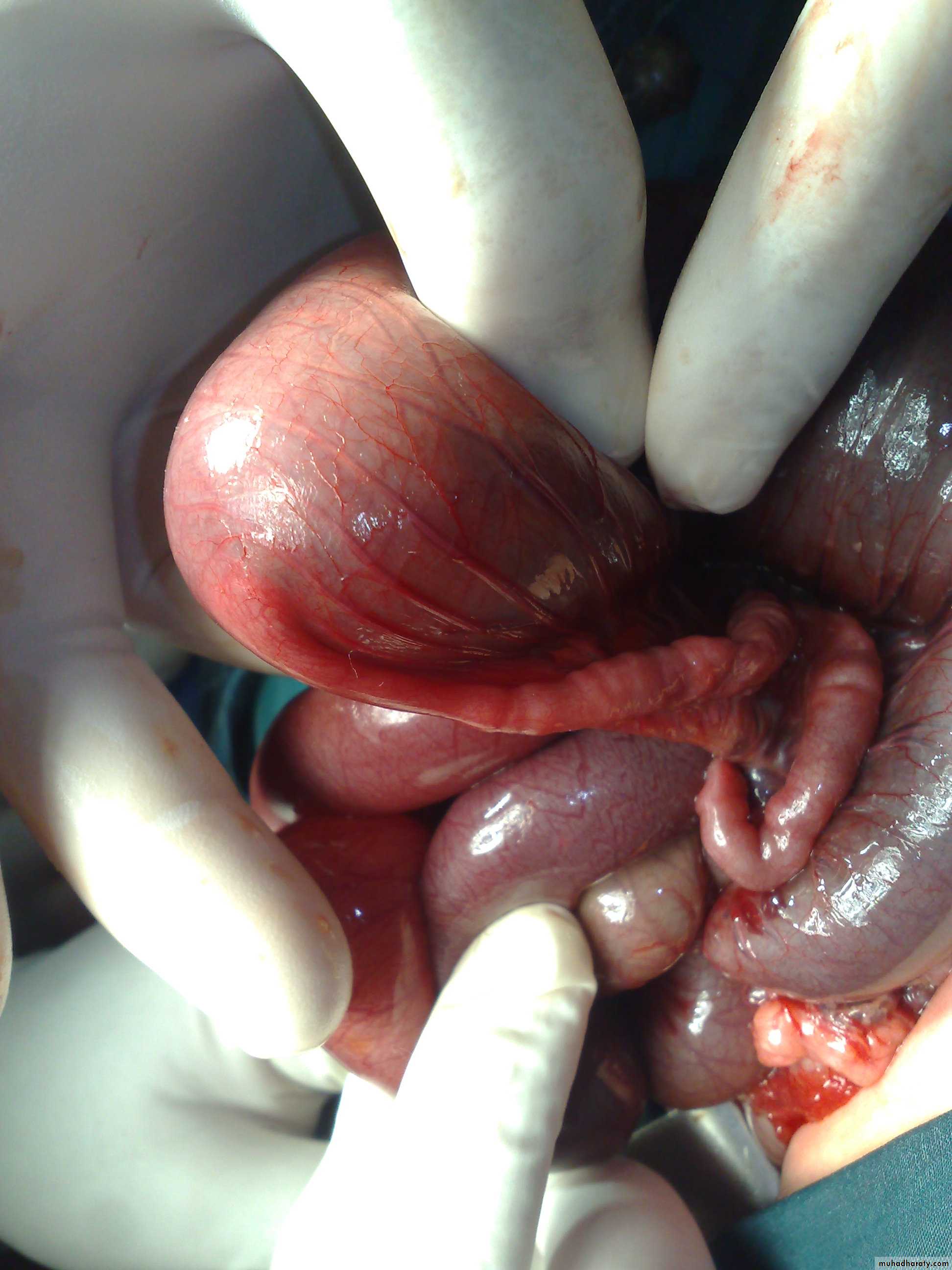 pediatric