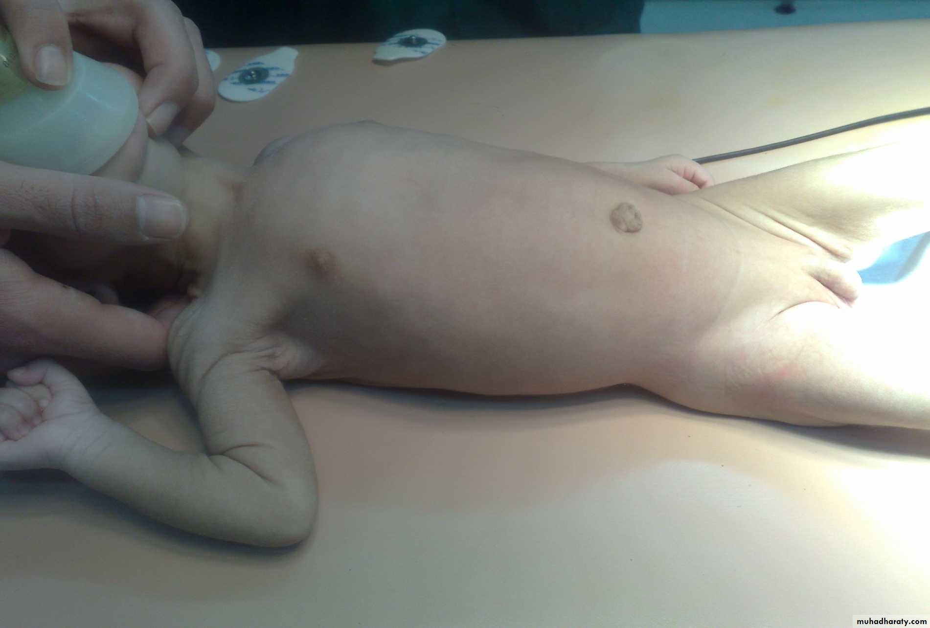 pediatric