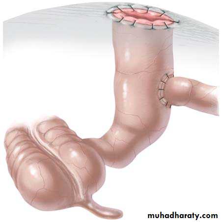 pediatric