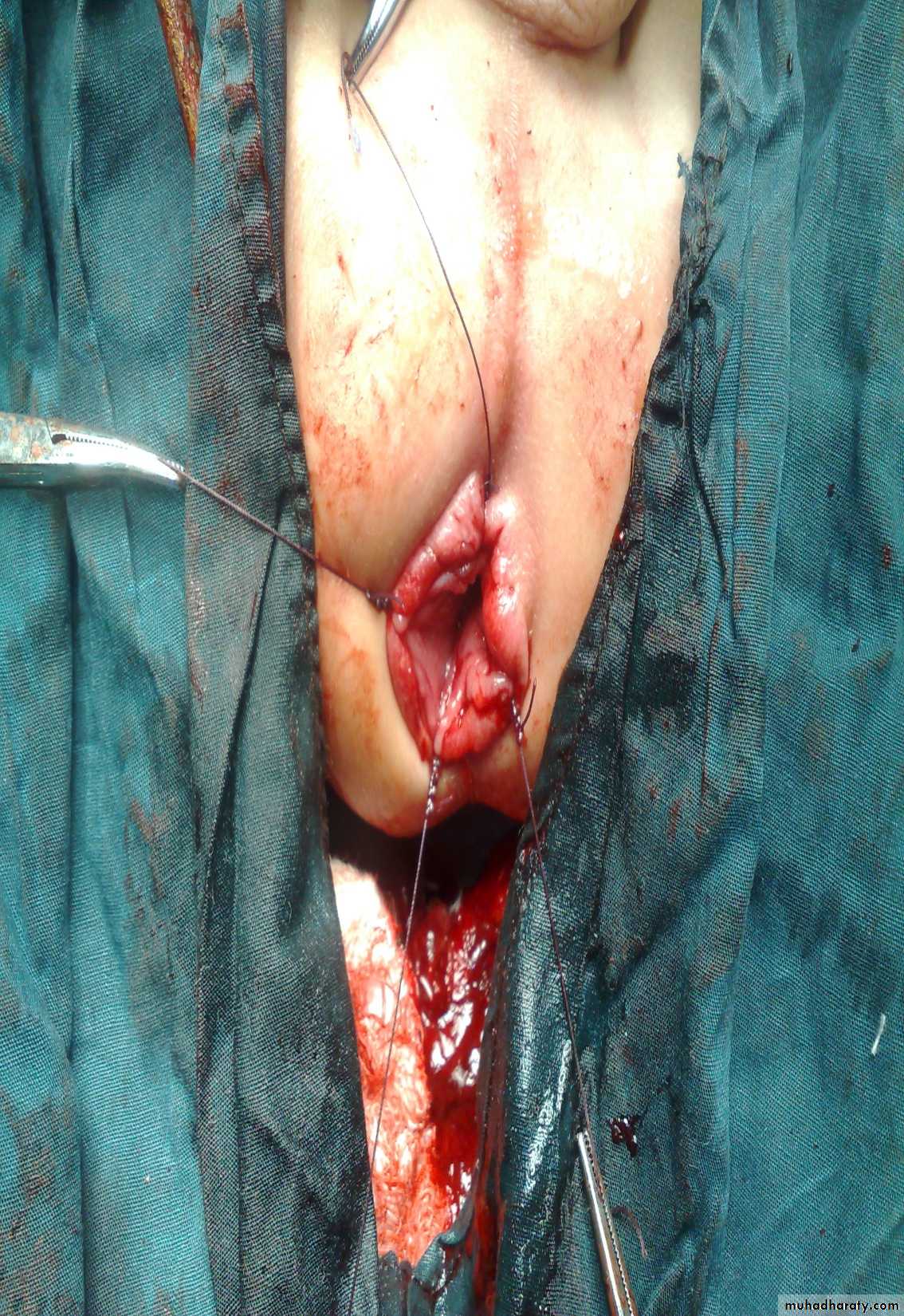pediatric