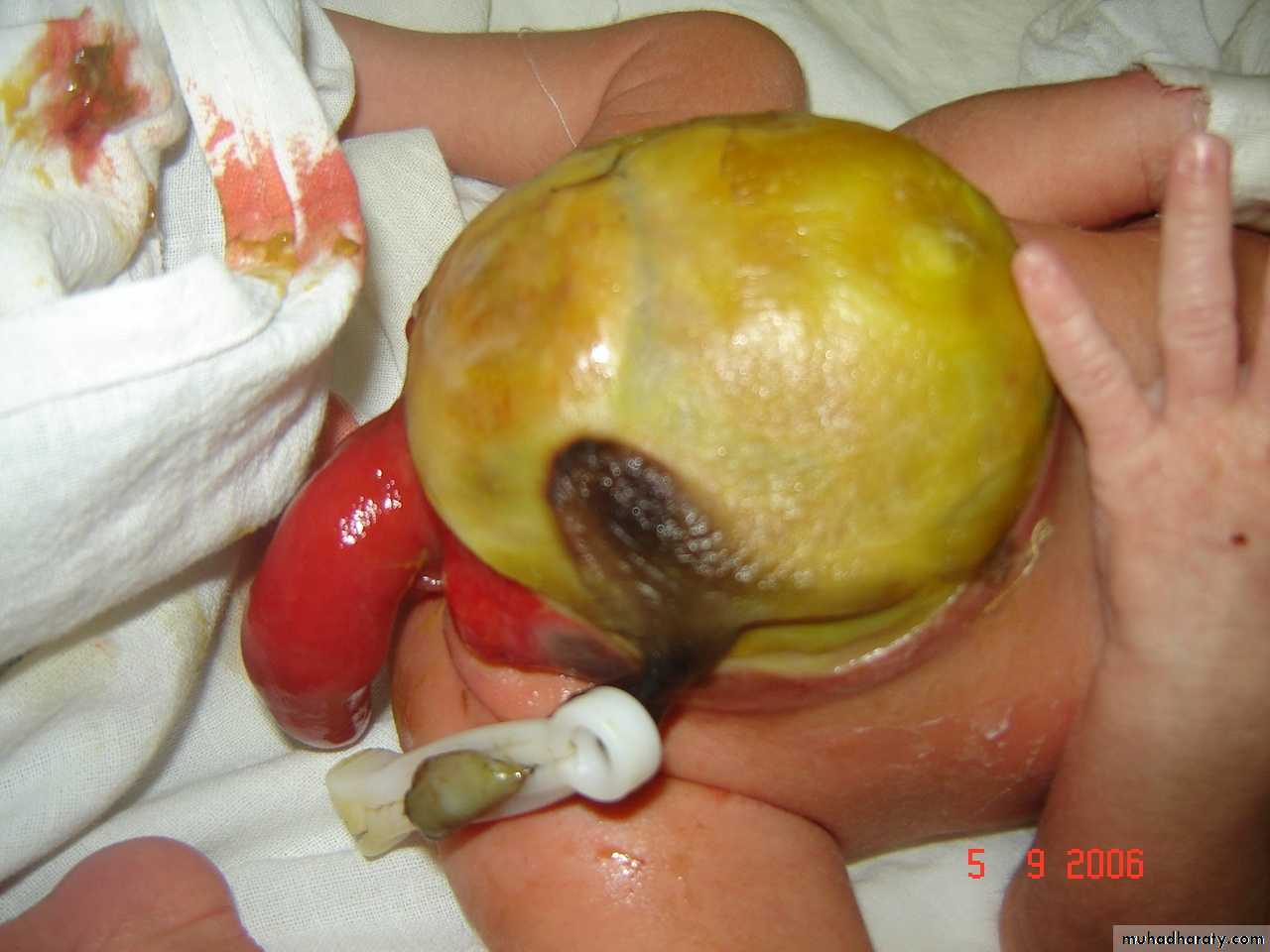 pediatric