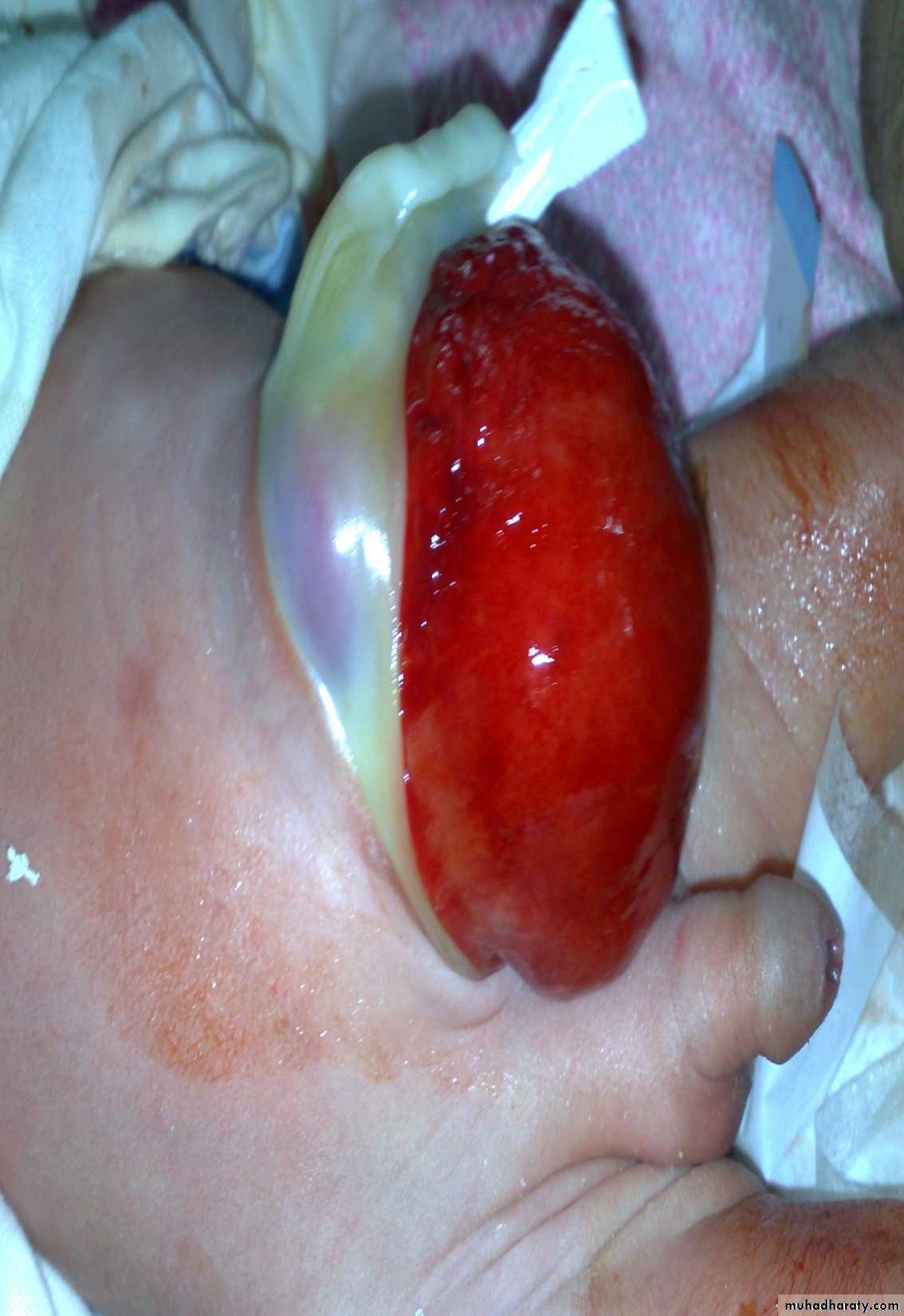 pediatric