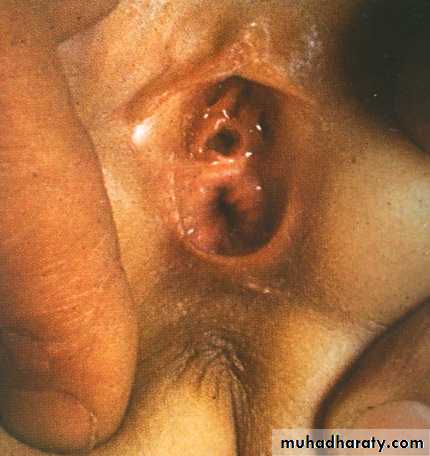 pediatric