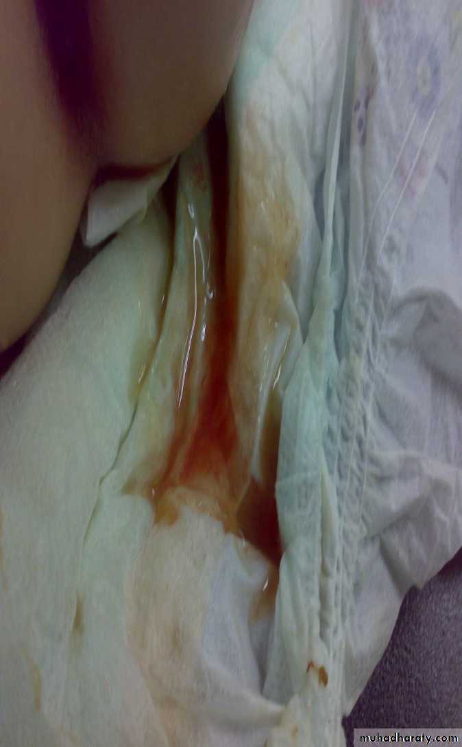 pediatric